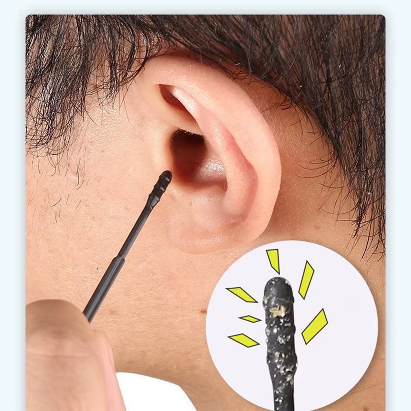 Ear Wax Remover - Bastone da scavo per orecchie adesivo