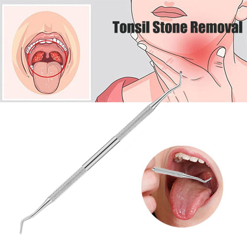 Ear Wax Remover - 1Pc Strumento per la rimozione del
