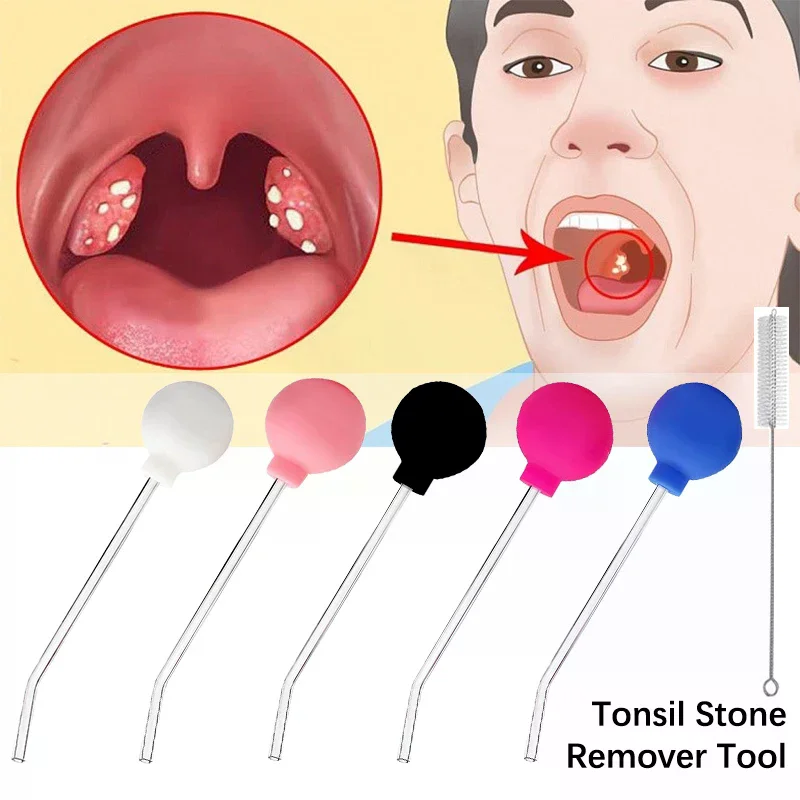 Strumento per la Rimozione del - Ear Wax Remover recensione e prezzo